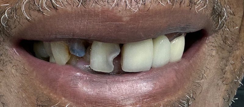 Website-Before-After-PDF-1A