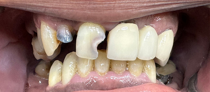 Website-Before-After-PDF-1B