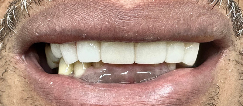 Website-Before-After-PDF-1C