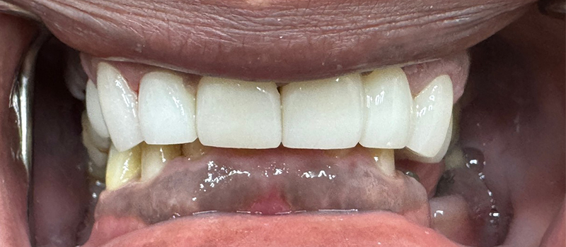 Website-Before-After-PDF-1D