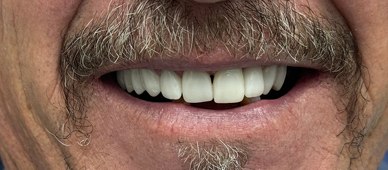 Website-Before-After-PDF-2A