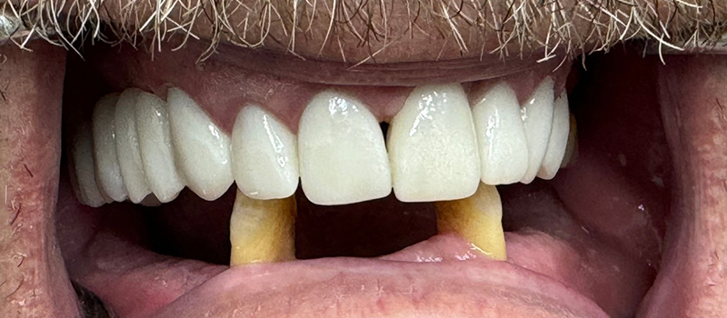 Website-Before-After-PDF-2B