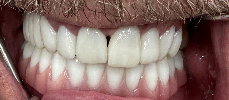 Website-Before-After-PDF-2C