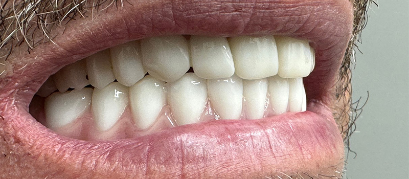 Website-Before-After-PDF-2D