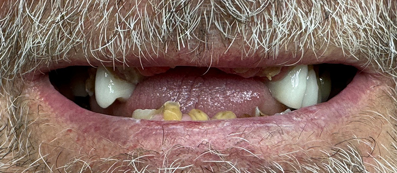 Website-Before-After-PDF-3A