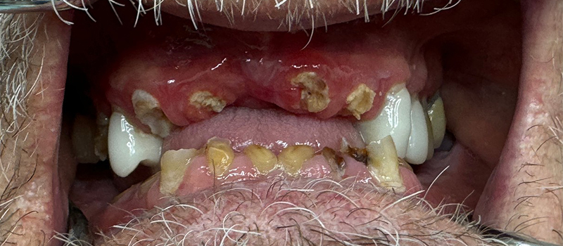 Website-Before-After-PDF-3B