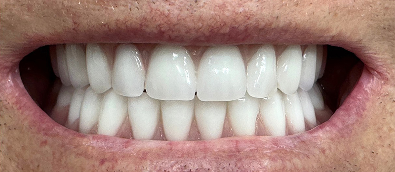 Website-Before-After-PDF-3C