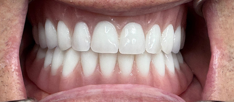 Website-Before-After-PDF-3D