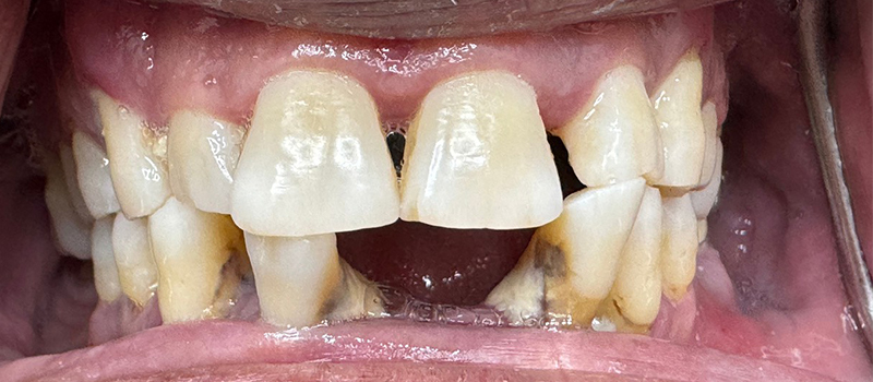 Website-Before-After-PDF-4A