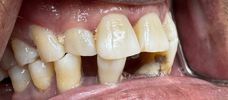 Website-Before-After-PDF-4B