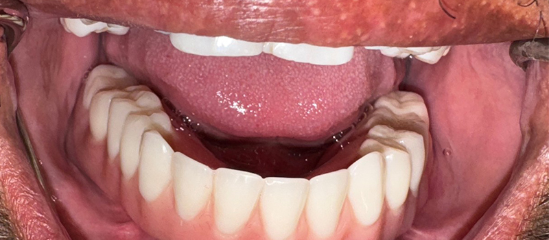 Website-Before-After-PDF-4C