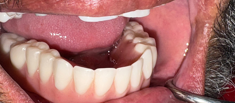 Website-Before-After-PDF-4D