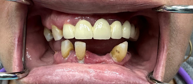 Website-Before-After-PDF-5A