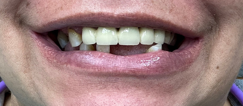 Website-Before-After-PDF-5B