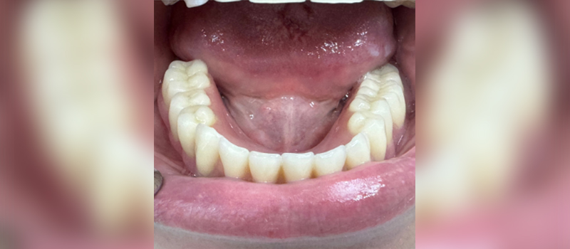 Website-Before-After-PDF-5C