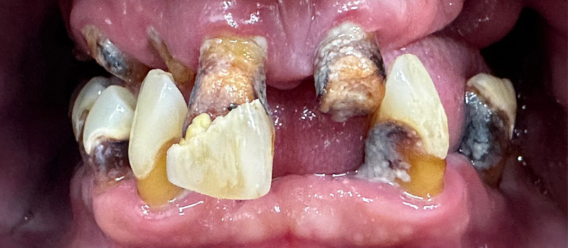 Website-Before-After-PDF-6A