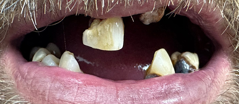 Website-Before-After-PDF-6B