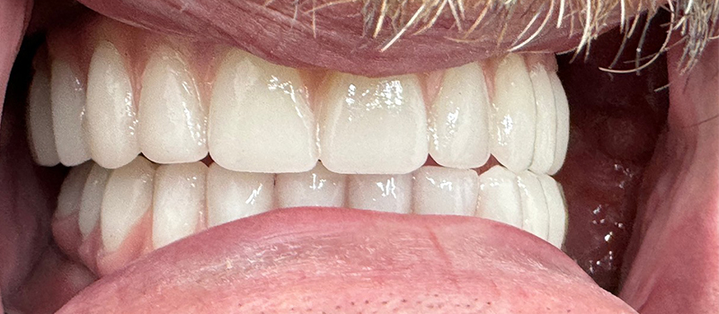 Website-Before-After-PDF-6C