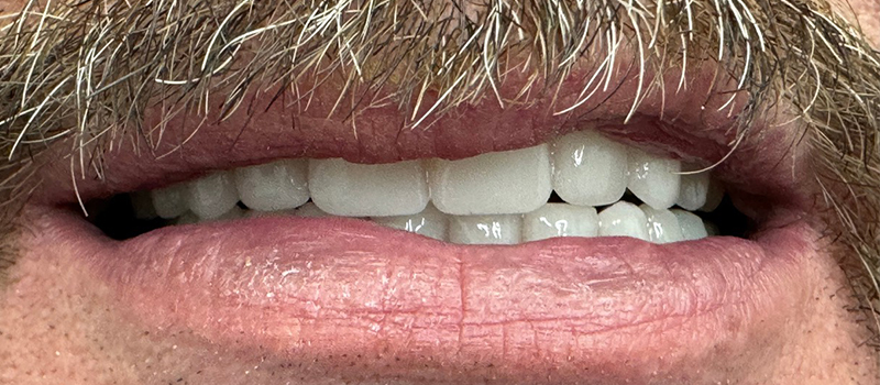 Website-Before-After-PDF-6D