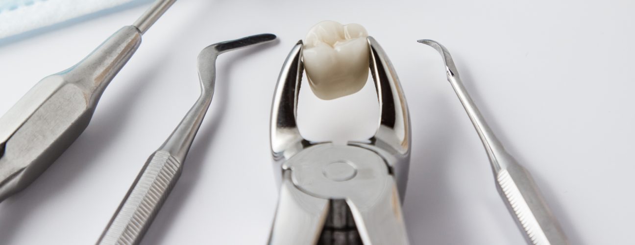 Tooth Extractions: When and Why They Are Necessary