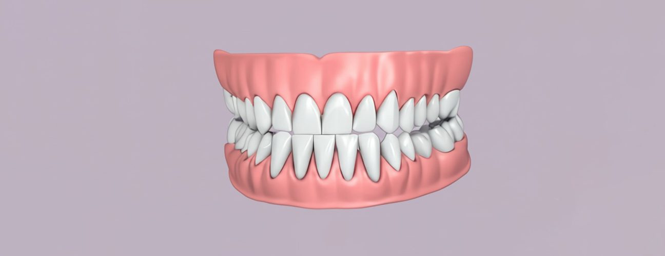 What Are Dentures? A Complete Guide to Tooth Replacement