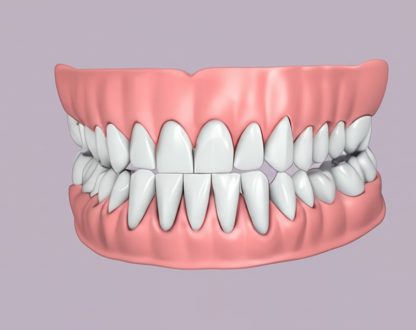 What Are Dentures? A Complete Guide to Tooth Replacement