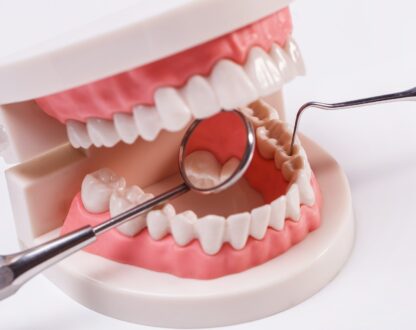 Are Dental Implants Right for You? A Complete Guide to Dental Implants in Spring, Tx