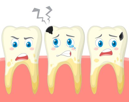 Why Dental Crowns are a Great Solution for Damaged or Weak Teeth